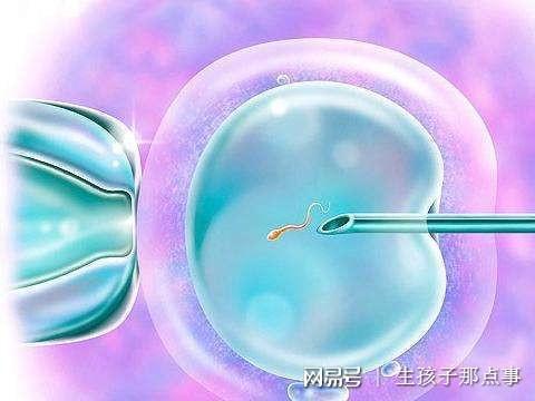 引产手术