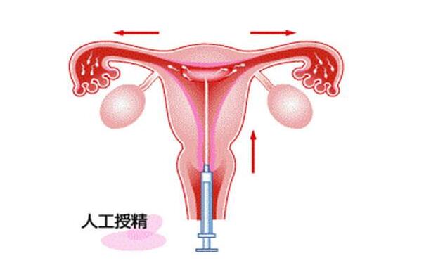 广西试管婴儿医院