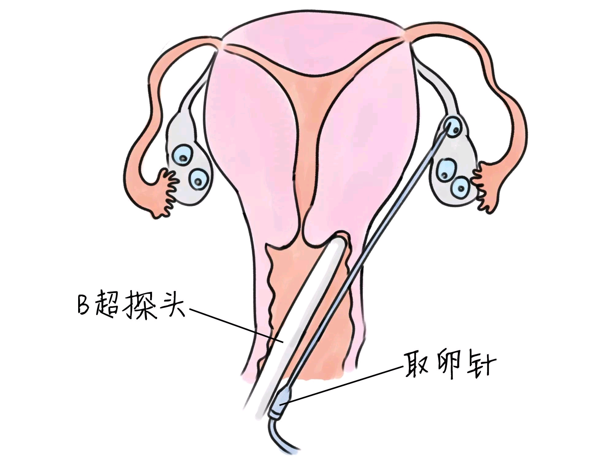 妇幼试管婴儿价格
