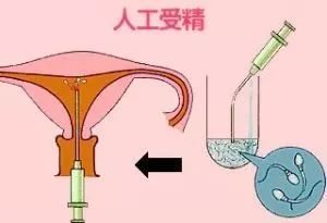 细胞移植