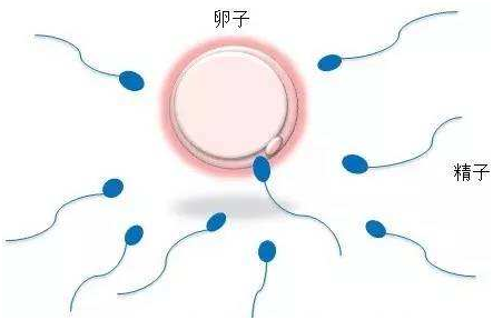 引产手术