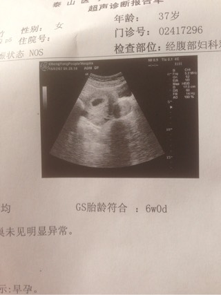 尿促试管