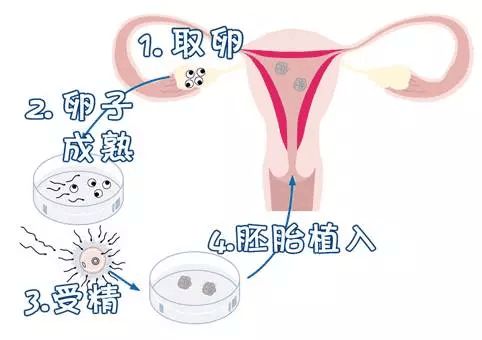 供卵试管