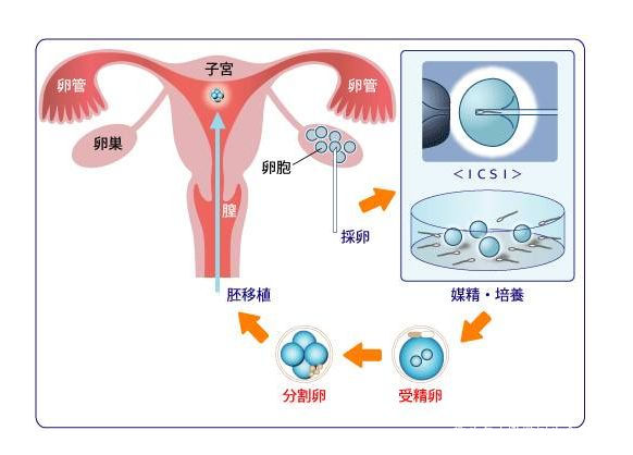 正规供卵试管婴儿医院
