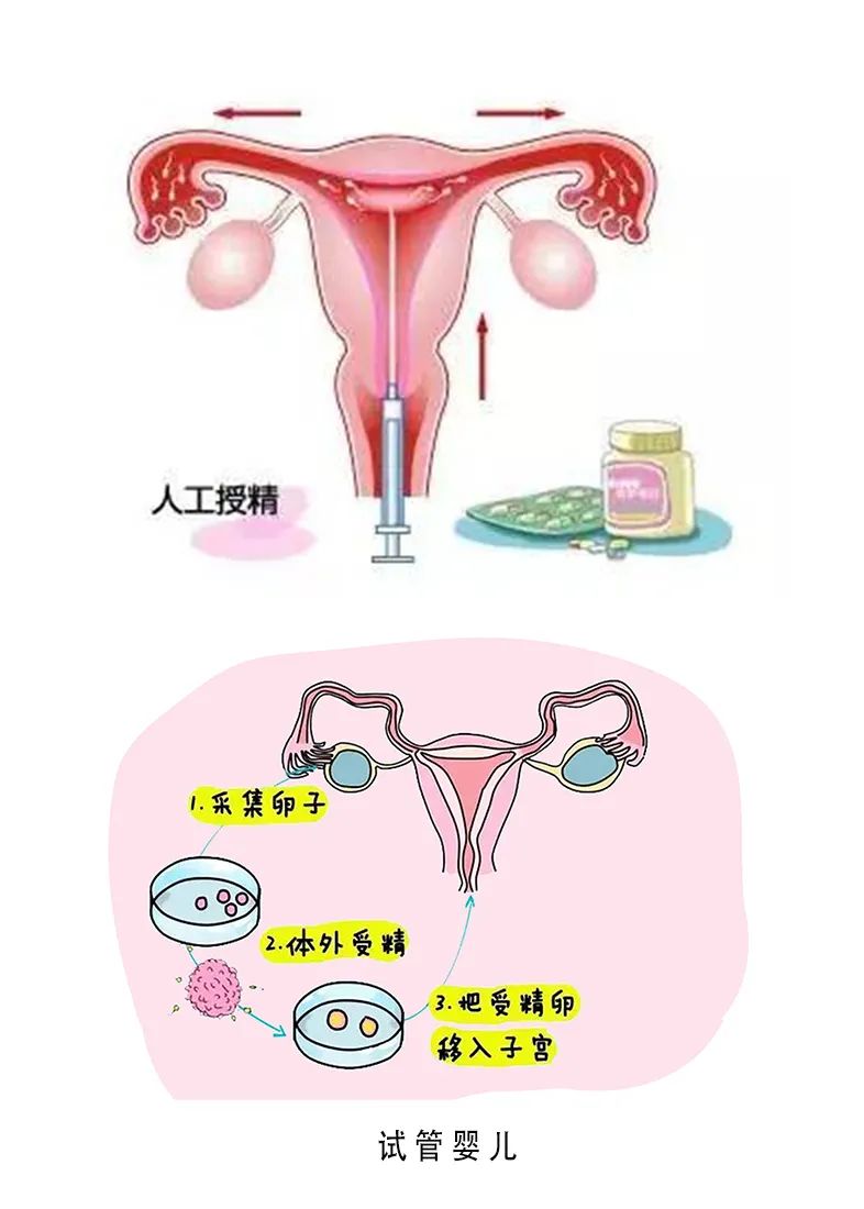 供卵试管婴儿机构
