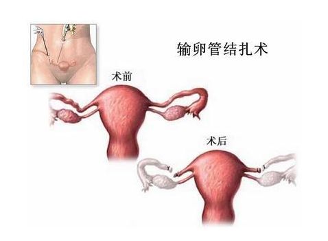 供卵试管医院